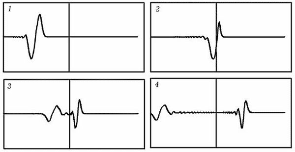 Рис. 5. Отражение импульса от границы раздела двух сред (решение волнового уравнения).